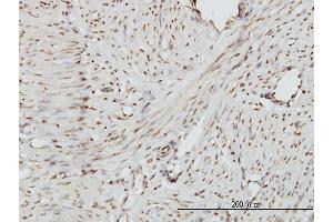 Image no. 4 for anti-Zinc Fingers and Homeoboxes 2 (ZHX2) (AA 691-788) antibody (ABIN564953)
