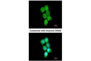 Image no. 6 for anti-Poly(rC) Binding Protein 2 (PCBP2) (Center) antibody (ABIN2856965)