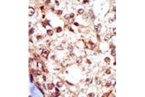 Image no. 2 for anti-Gardner-Rasheed Feline Sarcoma Viral (V-Fgr) Oncogene Homolog (FGR) (AA 11-40), (N-Term) antibody (ABIN359981)