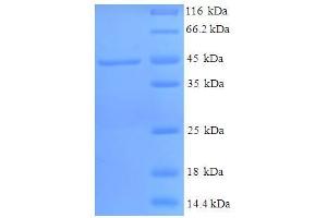 Image no. 1 for Hydroxysteroid (11-Beta) Dehydrogenase 1 (HSD11B1) (AA 25-292) protein (His-SUMO Tag) (ABIN5709687)