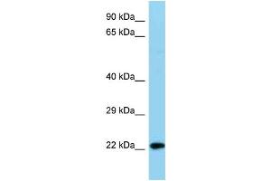 Image no. 1 for anti-NADH Dehydrogenase (Ubiquinone) 1 beta Subcomplex, 8, 19kDa (NDUFB8) (C-Term) antibody (ABIN2782660)