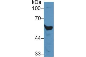 Image no. 2 for Cytochrome P450, Family 2, Subfamily E, Polypeptide 1 (CYP2E1) ELISA Kit (ABIN6720507)