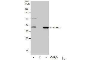 Image no. 5 for anti-Aldo-Keto Reductase Family 1, Member C3 (3-alpha Hydroxysteroid Dehydrogenase, Type II) (AKR1C3) (C-Term) antibody (ABIN2855872)