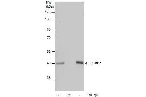 Image no. 4 for anti-Poly(rC) Binding Protein 2 (PCBP2) (Center) antibody (ABIN2856965)