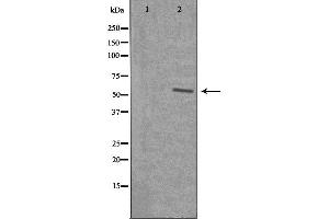 Image no. 1 for anti-Splicing Factor 3b, Subunit 4, 49kDa (SF3B4) (N-Term) antibody (ABIN6259186)