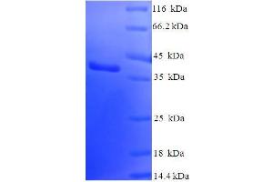 Image no. 1 for SUMO/sentrin Specific Peptidase Family Member 8 (SENP8) (AA 1-212), (full length) protein (His-SUMO Tag) (ABIN5711537)