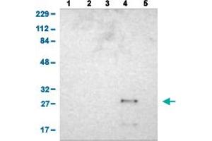 Image no. 1 for anti-Ankyrin Repeat and SOCS Box Containing 6 (ASB6) (AA 10-133) antibody (ABIN5774333)