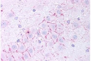 Human Dentate Gyrus (formalin-fixed, paraffin-embedded) stained with TAAR5 antibody ABIN213486 at 20 ug/ml followed by biotinylated goat anti-rabbit IgG secondary antibody ABIN481713, alkaline phosphatase-streptavidin and chromogen.