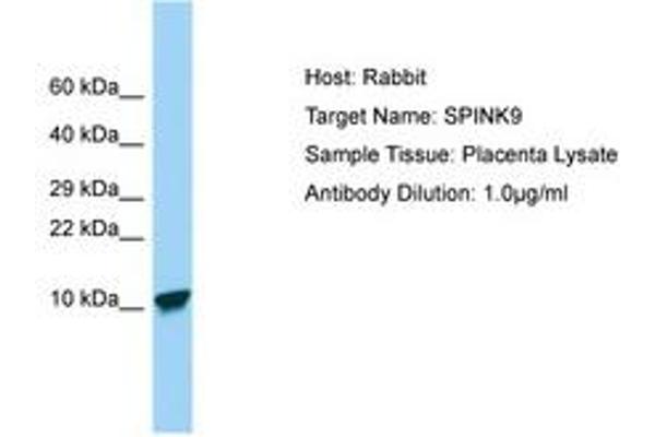 SPINK9 antibody  (C-Term)
