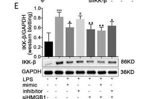 Image no. 1 for anti-Inhibitor of kappa Light Polypeptide Gene Enhancer in B-Cells, Kinase beta (IKBKB) antibody (ABIN3022876)