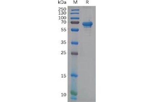 Natural Cytotoxicity Triggering Receptor 1 (NCR1) protein (Fc Tag)