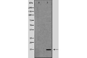 Western blot analysis of Hela whole cell lysates, using PFN1  Antibody.