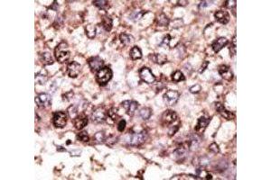 Image no. 2 for anti-Sirtuin 7 (SIRT7) (AA 331-360) antibody (ABIN3032600)