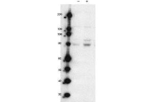 Image no. 1 for anti-MAP/microtubule Affinity-Regulating Kinase 2 (MARK2) (Isoform A), (pThr595) antibody (ABIN129661)