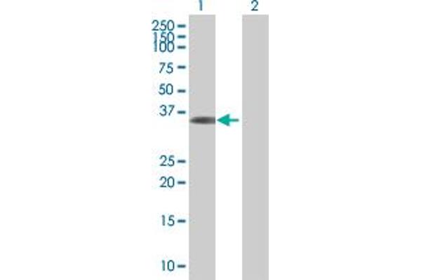 anti-Zinc Finger Protein 509 (ZBTB49) (AA 1-248) antibody