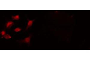 Image no. 2 for anti-Cleavage Stimulation Factor, 3' Pre-RNA, Subunit 2, 64kDa (CSTF2) antibody (ABIN6258037)