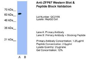 Image no. 5 for anti-Zinc Finger and BTB Domain Containing 7B (ZBTB7B) (Middle Region) antibody (ABIN2777563)