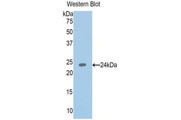 IGFBP6 antibody  (AA 31-240)
