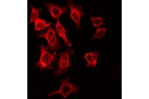 Image no. 3 for anti-Interleukin 2 Receptor, beta (IL2RB) (Internal Region) antibody (ABIN6262526)