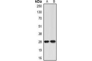 Image no. 2 for anti-Inhibitor of Growth Family, Member 5 (ING5) antibody (ABIN3197702)