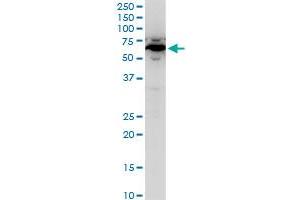 Image no. 2 for anti-serine Palmitoyltransferase, Long Chain Base Subunit 2 (SPTLC2) (AA 453-561) antibody (ABIN564104)