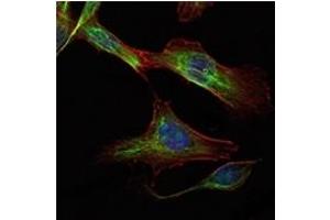 Image no. 1 for anti-RPTOR Independent Companion of mTOR, Complex 2 (RICTOR) antibody (ABIN1108880)