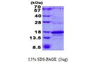 Image no. 1 for CD247 Molecule (CD247) protein (ABIN2128420)