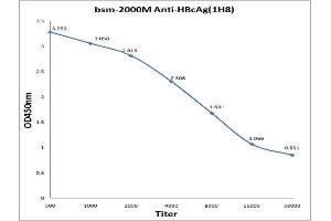 Image no. 1 for anti-Hepatitis B Virus Core Antigen (HBcAg) antibody (ABIN722991)
