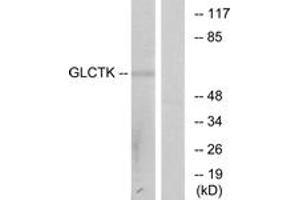 anti-Glycerate Kinase (GLYCTK) (AA 101-150) antibody