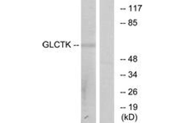 anti-Glycerate Kinase (GLYCTK) (AA 101-150) antibody