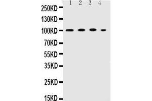 Image no. 1 for anti-Intercellular Adhesion Molecule 1 (ICAM1) (AA 214-532) antibody (ABIN3042516)