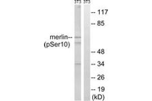 Image no. 2 for anti-Neurofibromin 2 (NF2) (AA 1-50), (pSer10) antibody (ABIN1532019)