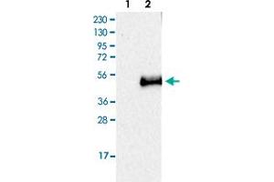Image no. 3 for anti-CD207 Molecule, Langerin (CD207) antibody (ABIN5574254)