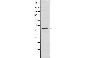 Image no. 1 for anti-Zinc Finger Protein 36, C3H Type-Like 2 (ZFP36L2) (Internal Region) antibody (ABIN6259621)