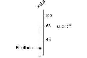 Image no. 1 for anti-Fibrillarin (FBL) antibody (ABIN361375)