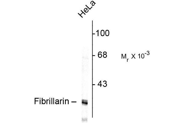 anti-Fibrillarin (FBL) antibody