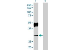 Image no. 2 for anti-ATPase, H+/K+ Exchanging, beta Polypeptide (ATP4b) (AA 1-291) antibody (ABIN513611)