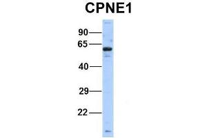 Image no. 2 for anti-Copine I (CPNE1) (Middle Region) antibody (ABIN2778879)
