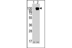 Image no. 1 for anti-Receptor Tyrosine Kinase-Like Orphan Receptor 1 (ROR1) (AA 112-399) antibody (ABIN5552249)
