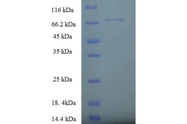 SPTLC2 Protein (AA 88-562, partial) (His-SUMO Tag)