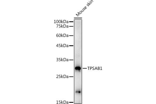 TPSAB1 antibody  (AA 19-210)