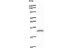 anti-Ovo-Like 1 (OVOL1) antibody
