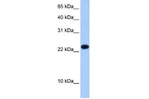 Image no. 1 for anti-Eukaryotic Translation Initiation Factor 4E Family Member 3 (EIF4E3) (Middle Region) antibody (ABIN2776663)
