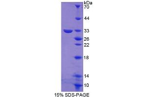 Image no. 1 for Guanylate Binding Protein 3 (GBP3) (AA 29-271) protein (His tag) (ABIN6239552)