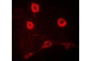 Image no. 1 for anti-Interleukin 12 Receptor beta 1 (IL12RB1) antibody (ABIN3197956)