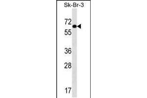 Image no. 1 for anti-Thyroid Hormone Receptor Interactor 4 (TRIP4) (AA 194-222) antibody (ABIN5533498)