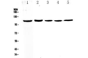 Image no. 1 for anti-Centriolar Coiled Coil Protein 110kDa (CCP110) (AA 51-284) antibody (ABIN5693312)