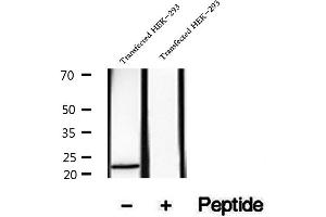 Image no. 2 for anti-Hepatitis B Virus X-Interacting Protein (HBXIP) (Internal Region) antibody (ABIN6262158)