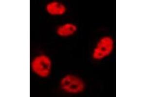 Image no. 3 for anti-Checkpoint with Forkhead and Ring Finger Domains (CHFR) antibody (ABIN6259505)