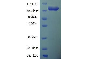 Image no. 1 for Epoxide Hydrolase 2, Cytoplasmic (EPHX2) (AA 1-555), (full length) protein (His-SUMO Tag) (ABIN5709475)
